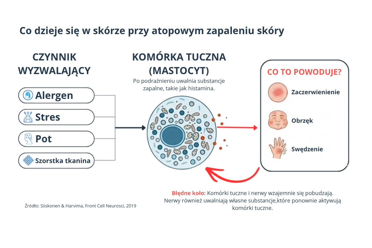 Co dzieje się w skórze przy atopowym zapaleniu: alergen, stres, pot i szorstka tkanina pobudzają komórkę tuczną, która uwalnia histaminę i wywołuje zaczerwienienie, obrzęk i swędzenie
